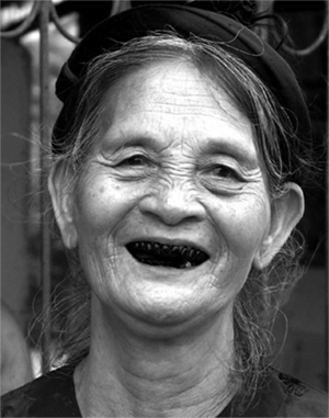 Vietnamese women with shiny black teeth